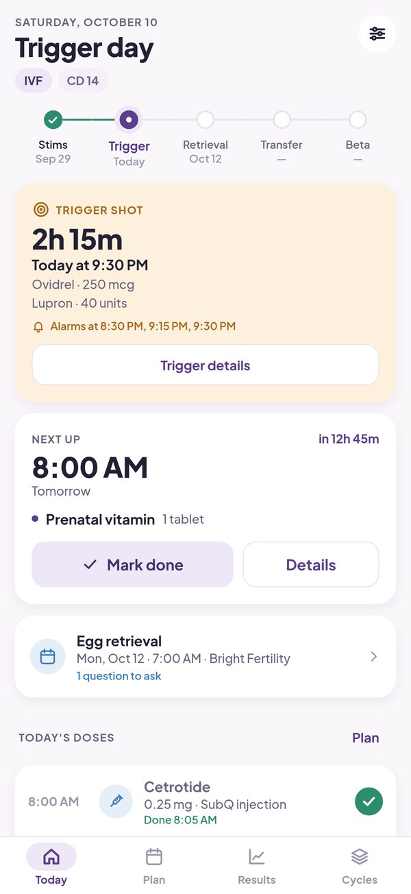 Trigger day: the trigger shot in 2 hours 15 minutes, with its alarm times